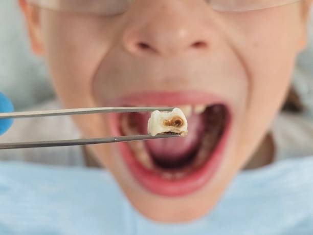 Best Weekend Emergency Dentist in Richfield, OH